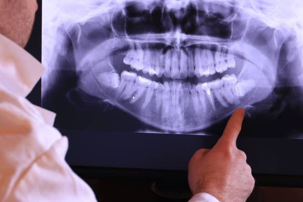 Best Weekend Emergency Dentist in Hamilton Square, NJ
