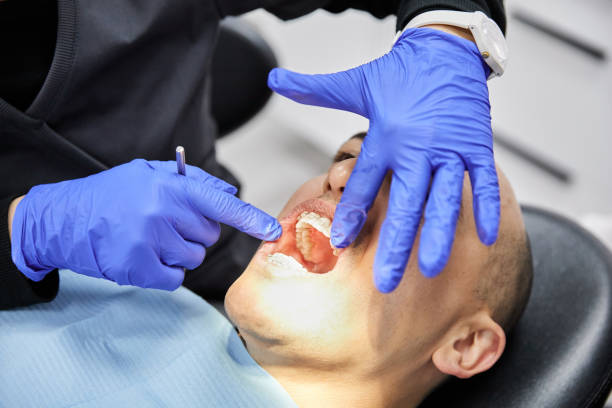 Best Emergency Broken Tooth Repair in Hamilton Square, NJ